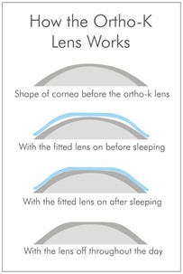 How the Otho-K Lens Works
